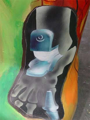 K&uuml;nstliches Gelenk