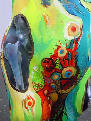 K&uuml;nstliches Gelenk